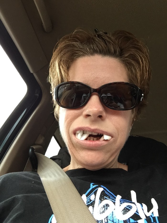 Going home after surgery. So much pain :( 